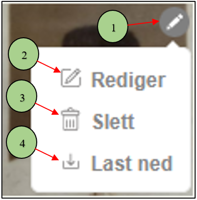 Multimediealternativer (rediger, slett, last ned)